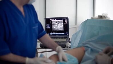 Surgery treatment of varicose veins