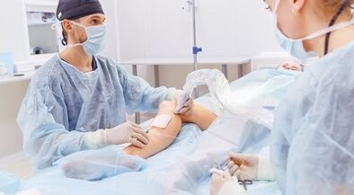 Varicocele surgery