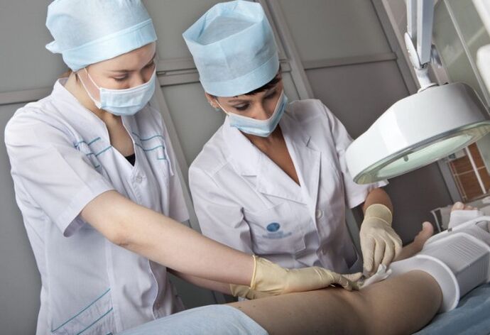 Surgery for varicose veins in the legs